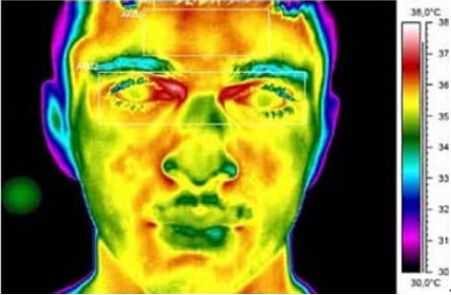 紅外熱像儀在中醫用的四項診斷功能