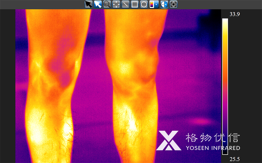 紅外熱像儀在中醫用的四項診斷功能