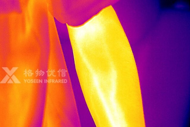 格物優信紅外熱像儀拍攝的人體胳膊熱像圖