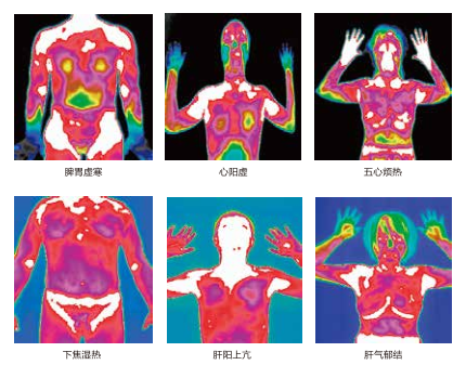 醫用紅外熱像儀和現代影像醫學診斷技術的區別