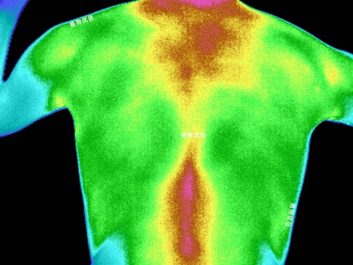 醫用紅外熱像儀效果圖