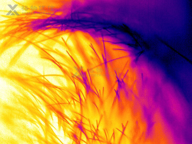 微距鏡頭清晰監測皮膚毛發