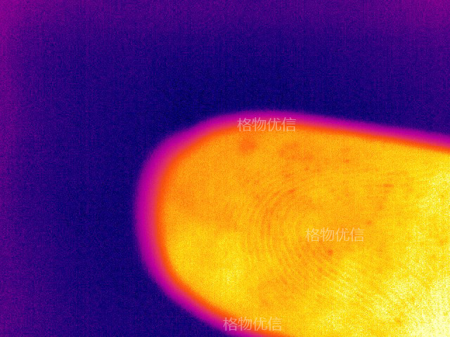 微距鏡頭清晰監測皮膚毛發