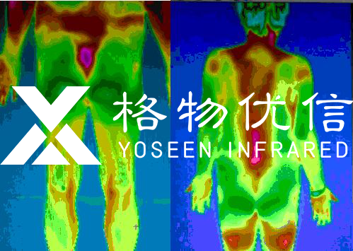 中醫診療可視化數字化紅外熱像儀的全面應用